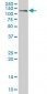 CDH17 / Cadherin 17 Antibody (clone 1H3)
